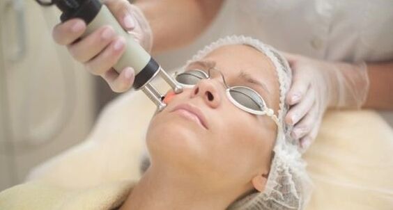 Laser renovation