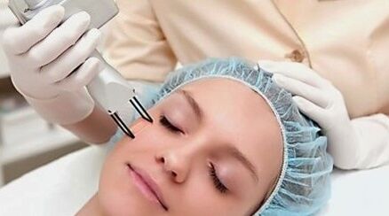 Laser renovation of the face